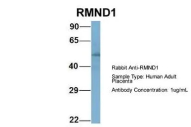 RMND1 antibody, Internal