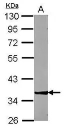 ZNF396 antibody