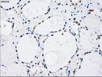 SEK1 / MKK4 antibody [8A8]