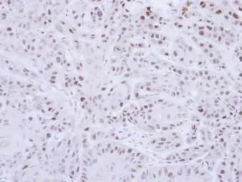 RAD18 antibody [N1C1]