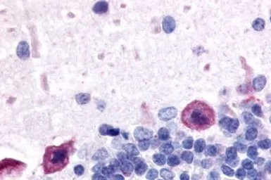 Adenosine A1 Receptor antibody