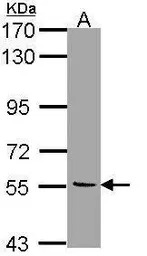 Monoamine Oxidase B antibody [