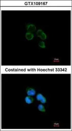 HIBCH antibody