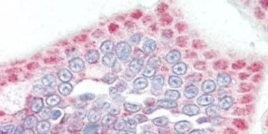 SLC33A1 antibody, Internal