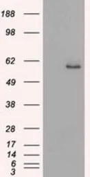 Cytokeratin 8 antibody [4D12]