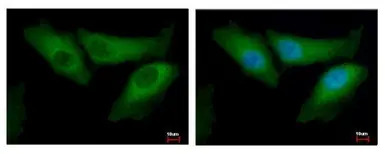 Bid antibody [N1C3-2]