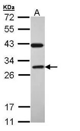 RAB3C antibody [N1C3]
