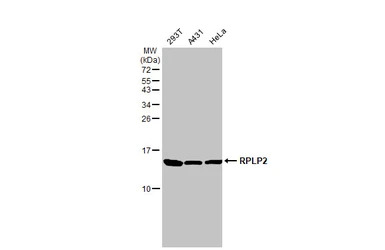 RPLP2 antibody