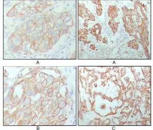 Cytokeratin 8 antibody [8A5D12
