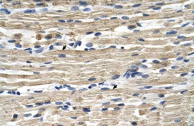 GSTM2 antibody, N-term