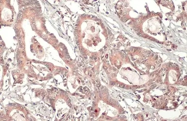 MMP7 antibody [C2C3], C-term