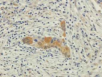 EPO receptor antibody