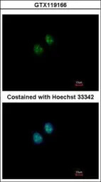 NAT10 antibody [N1N2], N-term