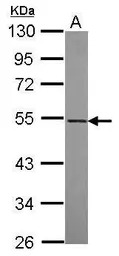 RASGEF1A antibody [N1C1]