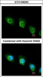 USP47 antibody