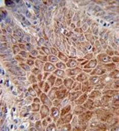 IGH antibody, C-term