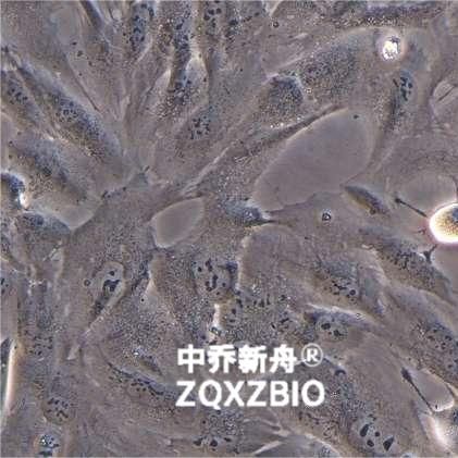 HRMVPC-Immortalized人视网膜周细胞-永生化