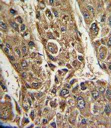 MTTP antibody, C-term