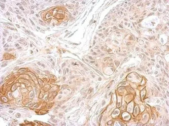 Sodium/Potassium ATPase beta 1