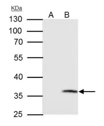 VDAC2 antibody [C2C3], C-term