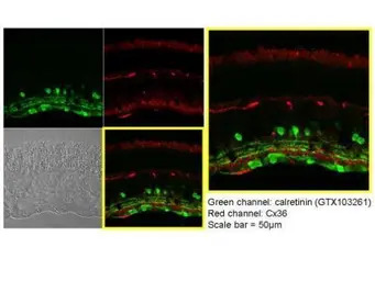 Calretinin antibody