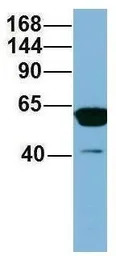 C17ORF71 antibody, Internal