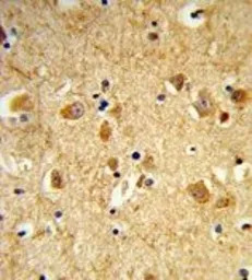 Dynamin 3 antibody, Internal