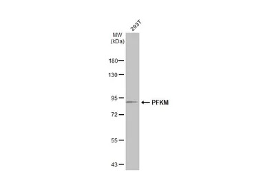 PFKM antibody [C1C3]