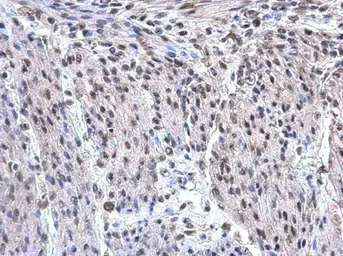 hnRNP F antibody [N1N3]