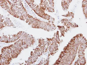 MRPS23 antibody [N1C3]