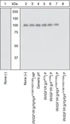 IGF1R (phospho Tyr1131 / Tyr11