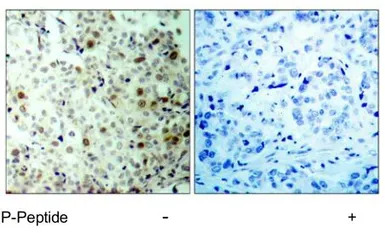 CDK2 (phospho Thr160) antibody