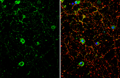 Dopamine Receptor D1 antibody 