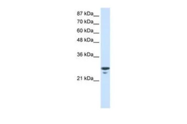 mtTFA antibody, N-term