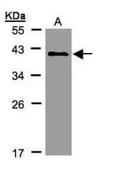 KLHDC8A antibody [C2C3], C-ter