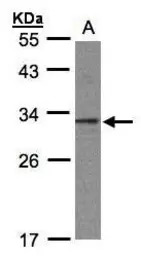 C20orf11 antibody [N1C3]