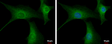 PPP2R3A antibody [C2C3], C-ter