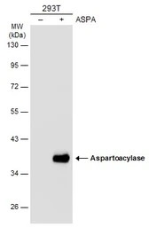 Aspartoacylase antibody