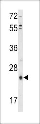 TIMP3 antibody, Internal