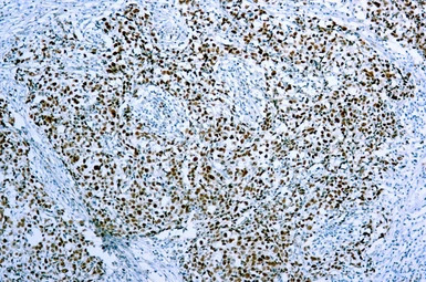 MCM7 antibody [47DC141]