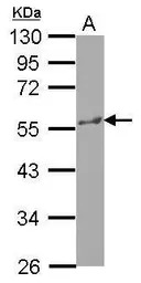 KATNA1 antibody [N1N3]