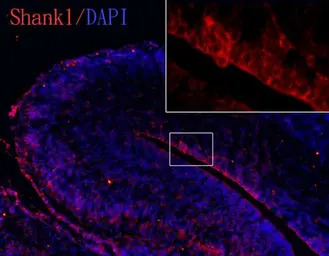 SHANK1 antibody [C3], C-term