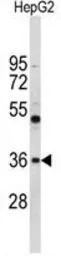 ELOVL2 antibody, N-term