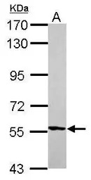 GPI antibody