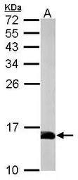 Profilin 2 antibody