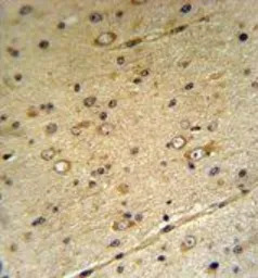 ZIP3 antibody, Internal