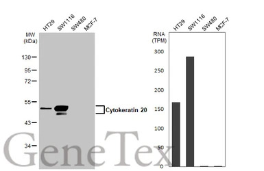 Cytokeratin 20 antibody [N2C2]