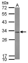 CCDC44 antibody [N1N3]