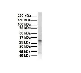 ECHDC2 antibody, Internal