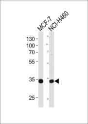 Tafazzin / TAZ antibody, N-ter